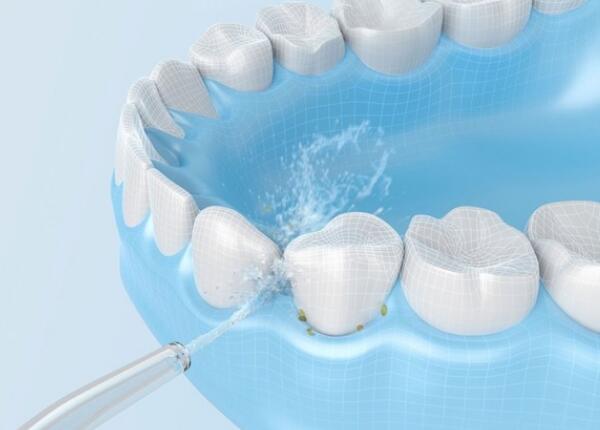 電動沖牙器的正確使用方法 電動沖牙器的正確使用方法